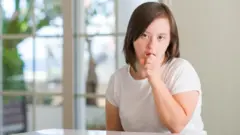 डाउन सिंड्रोम