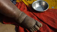 Dhukkubsattoota toonnoo irratti qollifannaan garagaraa ni dhaqqaba