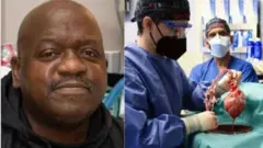 Rick Slayman ati awọn dokita to mu kindinrin ẹlẹdẹ lọwọ