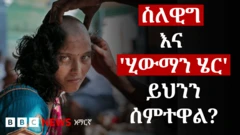 ፀጉሯ በከፊል የተመለጠ ሴት