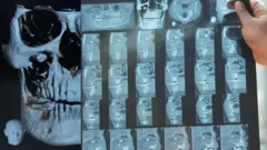 આંખમાં દાંત, બીબીસી ગુજરાતી