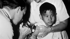 Un niño siendo vacunado contra la viruela