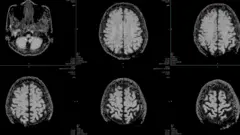 Várias imagens do cérebro humano dispostas lado a lado