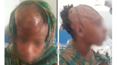 Dubartii wallaansa xannacha sammuu argatte