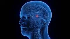 Ilustração mostrando a amígdala no cérebro