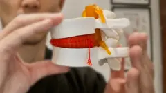 Fisioterapeuta segura um modelo das juntas