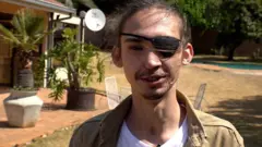 Afrika i životinje: Kako se oporaviti od napada hijene