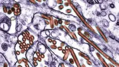 Imagem do vírus H5N1