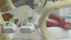 One of the nonuplets in an incubator in Casablanca, Morocco