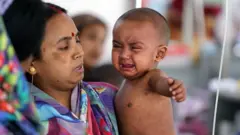 A baby spotted with measles marks cries, sitting on the hip of a women who looks at them with concern.