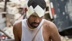 Hombre herido tras los terremotos en Venezuela
