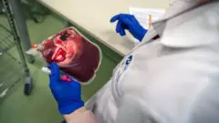 제대혈을 손에 들고 있는 사람