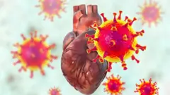 గుండెపోటు