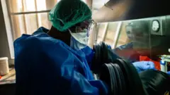 Delta state strange disease
