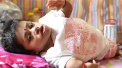 ગિરીજા, હાડકાંની બીમારી, પ્રેરણાત્મક કહાણી, બીબીસી ગુજરાતી 