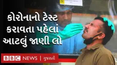 કેવી રીતે કરાવશો? કોરોનાનો ટેસ્ટ શું છે નિયમો?