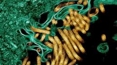 Nouvelle épidémie d'Ebola : des dizaines de morts dans l'est de la RDC