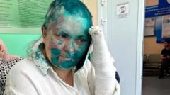 Елена Милашина после нападения