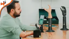 أطراف اصطناعية ذكية باستخدام التكنولوجيا المتقدمة