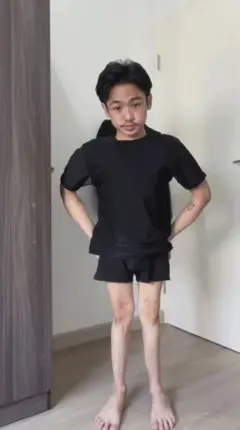 "ภวินท์" ก้าวข้ามการใส่เฝือกทั้งตัว สู่แฟชันสร้างแรงใจใช้ชีวิต