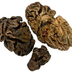 Fragmentos cerebrais de um indivíduo enterrado no Reino Unido há quase 200 anos