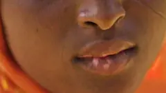 ንሓንቲ ጓላ ኣብ ከንፈራ ለምጺ ዝመስል በሰላ ገዲፉላ