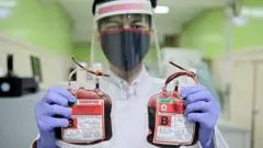 blood transfusion