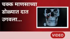 थंबनेल