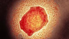 بیزوګي چیچک