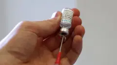 குரங்கம்மை