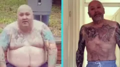 Ex-obeso