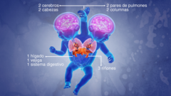 Ilustración de los órganos internos de las niñas