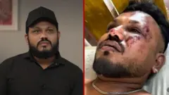 विश्वास कुमार रमेश हे अहमदाबाद इथं झालेल्या विमान अपघातातून बचावलेले एकमेव व्यक्ती आहे.