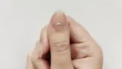 નખ, સ્વાસ્થ્ય, બીમારી, રોગ, હૅલ્થ, બીબીસી ગુજરાતી 