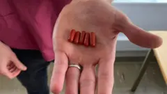 Five dark red pill capsules being held in the palm of a doctor's hand