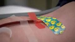 plazma treatment