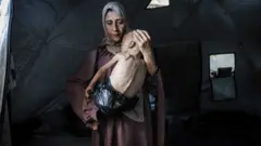 izgladnelo dete u gazi, u narucju majke