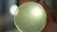 An illuminated Petri plate with a bright light with white yeast spots.