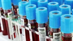 রক্তের টিউব