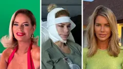 Imagem composta de Caroline Stanbury antes e depois da cirurgia de lifting facial. Na primeira foto, ela olha para a câmera, com os cabelos loiros penteados para o lado direito. Ela veste uma blusa vermelha, usa grandes brincos de ouro e batom vermelho. Na foto do meio, Caroline aparece com bandagens envolvendo a cabeça e vestindo o que parece ser um avental de hospital. Na terceira imagem, ela exibe cabelos loiros longos, veste uma blusa verde clara e um colar de pérolas.