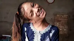 ኣፍሺን ሳሕቲ ዘጋጥም ሕማም ነይሩዋ