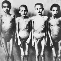 Opfer der Experimente des Nazi-Arzts Joseph Mengele
