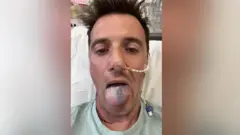 Anthony Perriam está sentado em uma cama de hospital com um tubo saindo de sua narina. Ele coloca a língua para fora, que apresenta uma cor azulada em metade de sua superfície