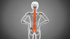 इंसान की पीठ का एक चित्र जिसमें रीढ़ की हड्डी को संतरी रंग में दिखाया गया है