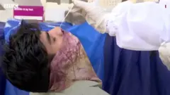 कोरोना वायरस