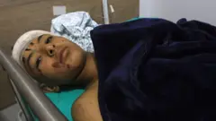 A boy with a bandaged head and cuts on his face lies in a hospital bed covered with a blanket

හිස වෙළුම් පටියක් දැමු මුහුණේ කැපුම් තුවාල සහිත පිරිමි ළමයෙක් බ්ලැන්කට්ටුවකින් ආවරණය කර රෝහල් ඇඳක වැතිර සිටියදී
