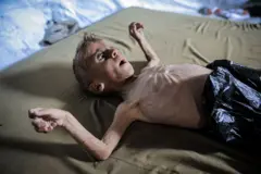الجوع بات يفتك بالأطفال في غزة 