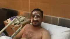 Beirut blast survivor