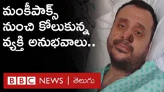 మంకీపాక్స్ వ్యాధి బారిన పడి కోలుకున్న వ్యక్తి అనుభవాలు