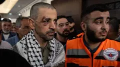 Un palestino que acaba de ser liberado y que tiene una herida alrededor del ojo. Porta una kufiya y va acompañado de un sanitario con un chaleco naranja.